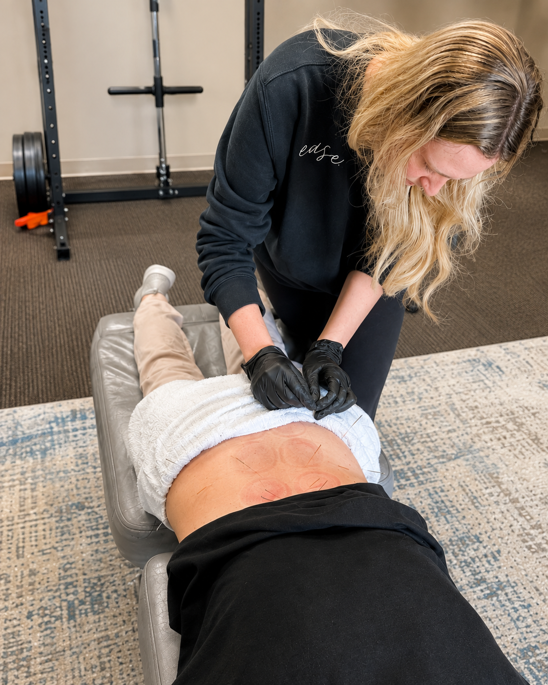 Who can do dry needling in Colorado, and what should you expect?